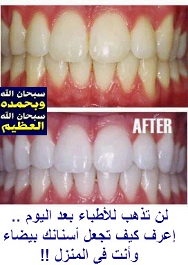 http://1.bp.blogspot.com/-6k1UssqLhNU/UfKa3xLjX1I/AAAAAAAAFjk/DXPglBZJYfM/s1600/661511748787.jpg