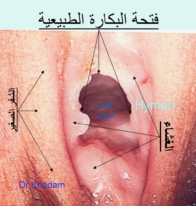 http://www.girls-ly.com/vb/storeimg/img_girls-ly1366587363_836.jpg